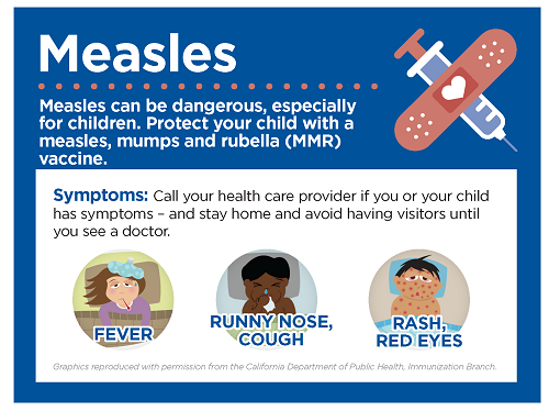Slide of measles symptoms including, fever, runny nose, cough, rash and red eyes.