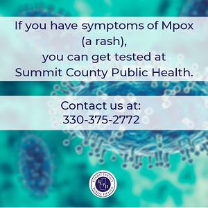 Image containing text to call the health department for monkeypox testing. 330-375-2772